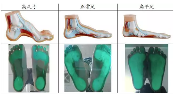 耐樂(lè)途功能鞋 保護(hù)兒童足部健康發(fā)育 陪伴孩子快樂(lè)成長(zhǎng)